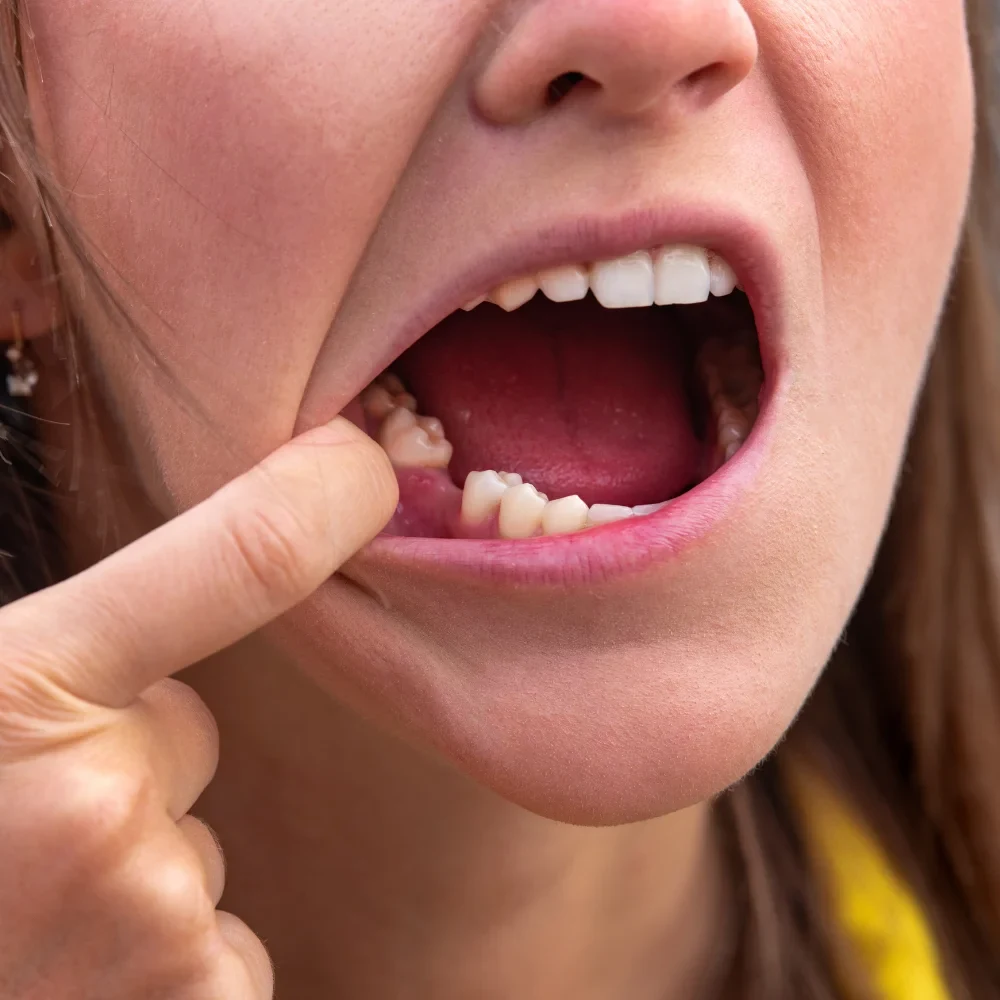 Patient indicating tooth pain that may require emergency dental care