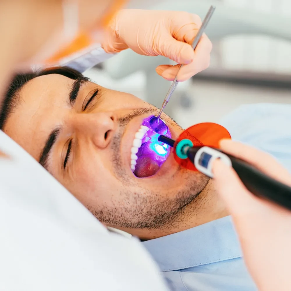 Dentist applying dental sealants to protect back teeth from cavities