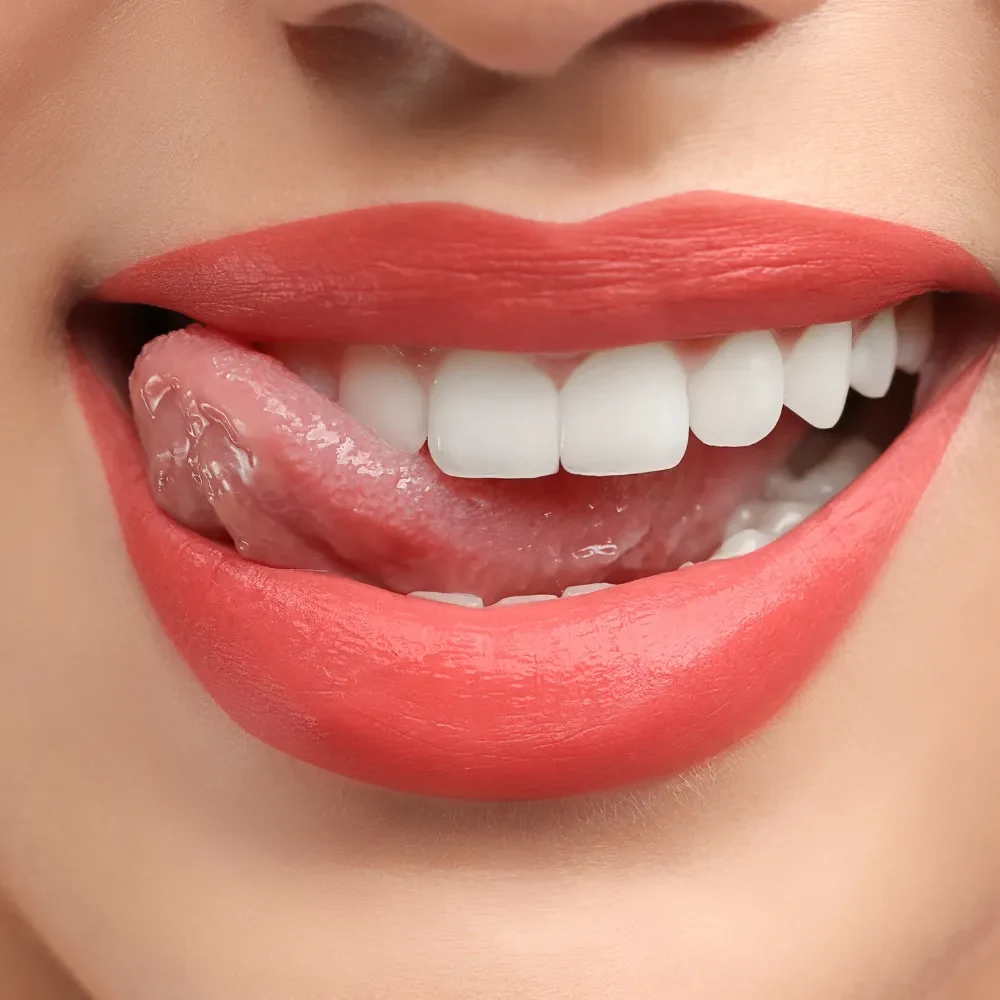 Close-up of smooth, natural-looking teeth after dental veneers treatment
