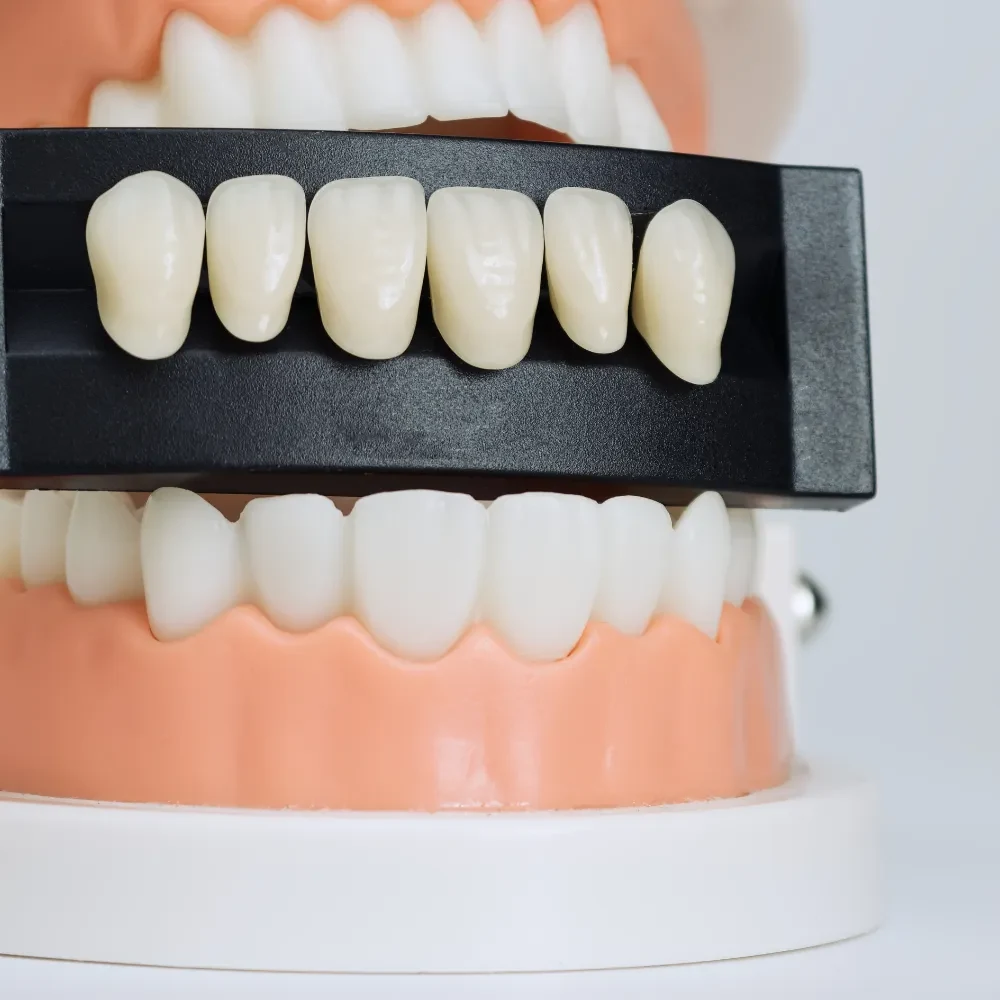 Dental veneers shade guide showing different tooth colors for smile design