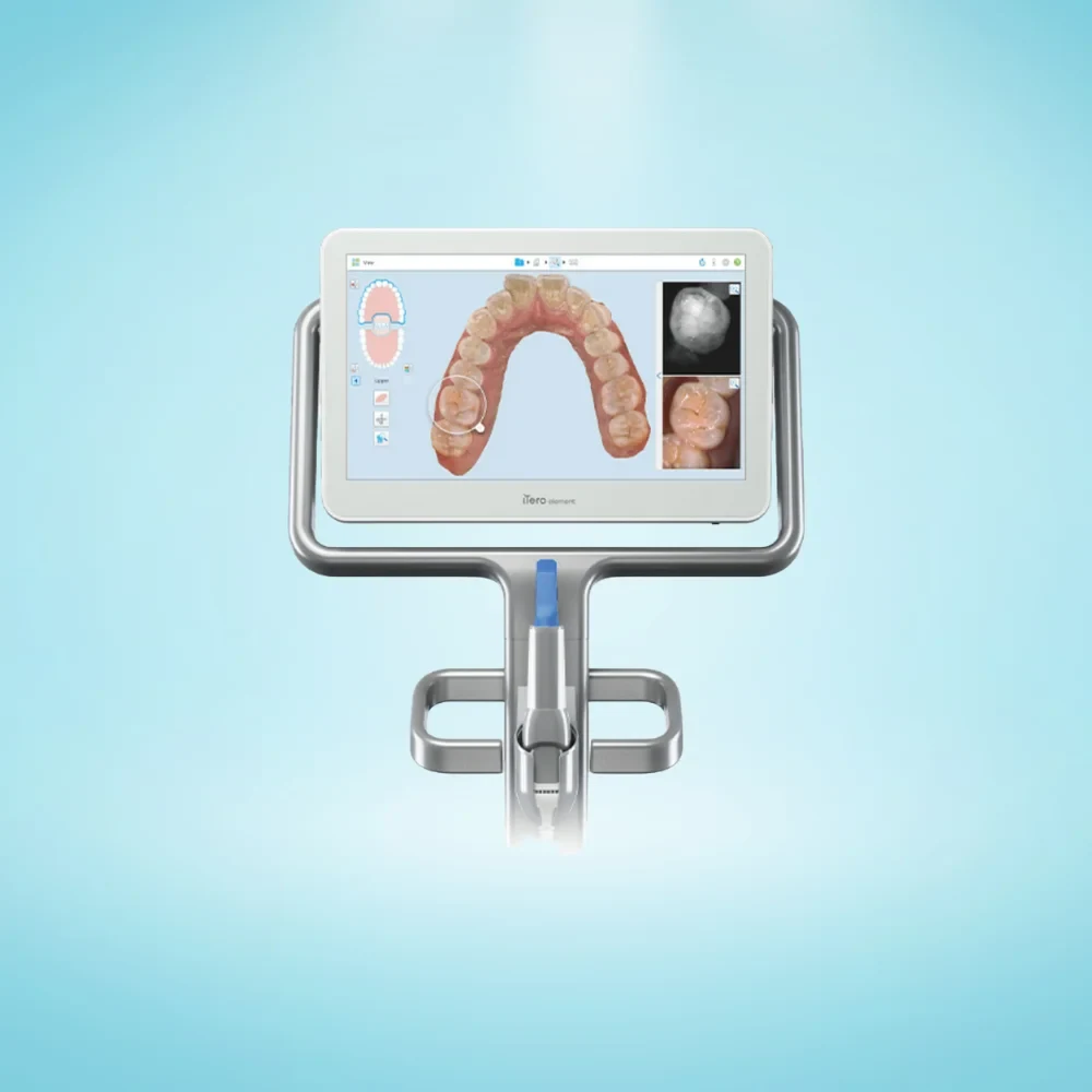 3D digital scan of teeth created using iTero intraoral scanner in Kitchener
