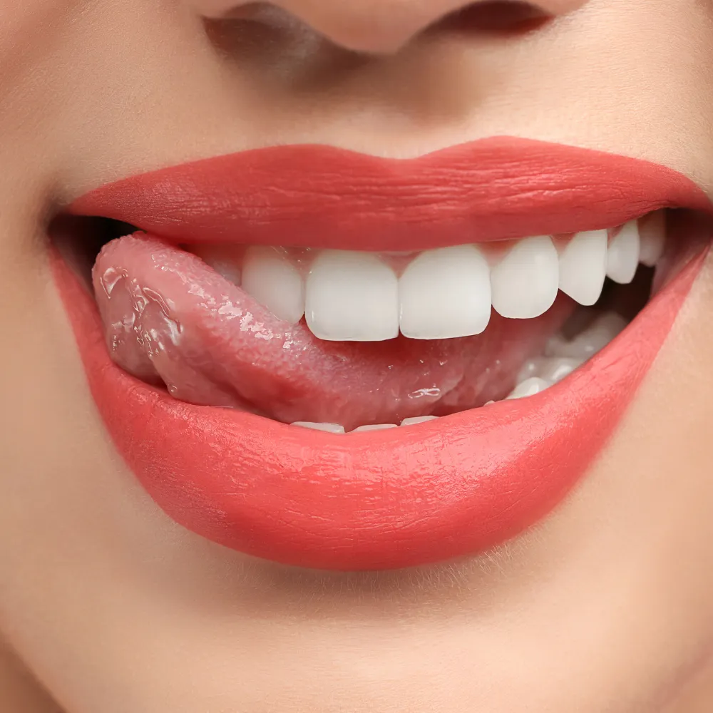 Close-up of smooth, natural-looking teeth after dental veneers treatment