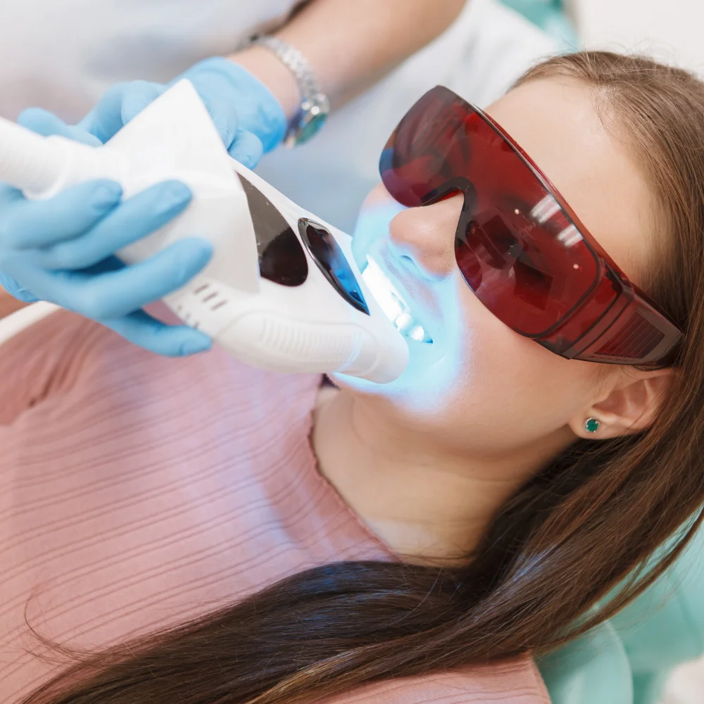 Professional teeth whitening treatment performed by a dentist in Kitchener