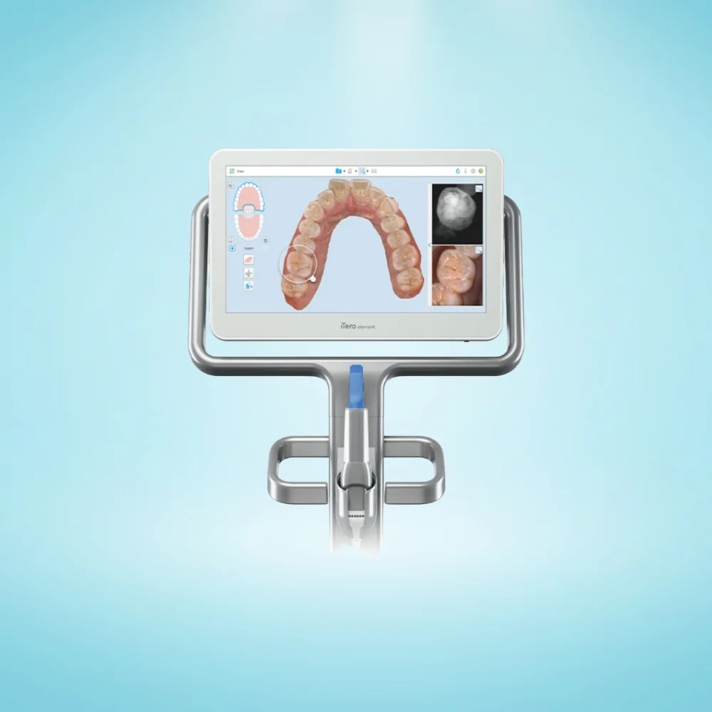 3D digital scan of teeth created using iTero intraoral scanner in Kitchener
